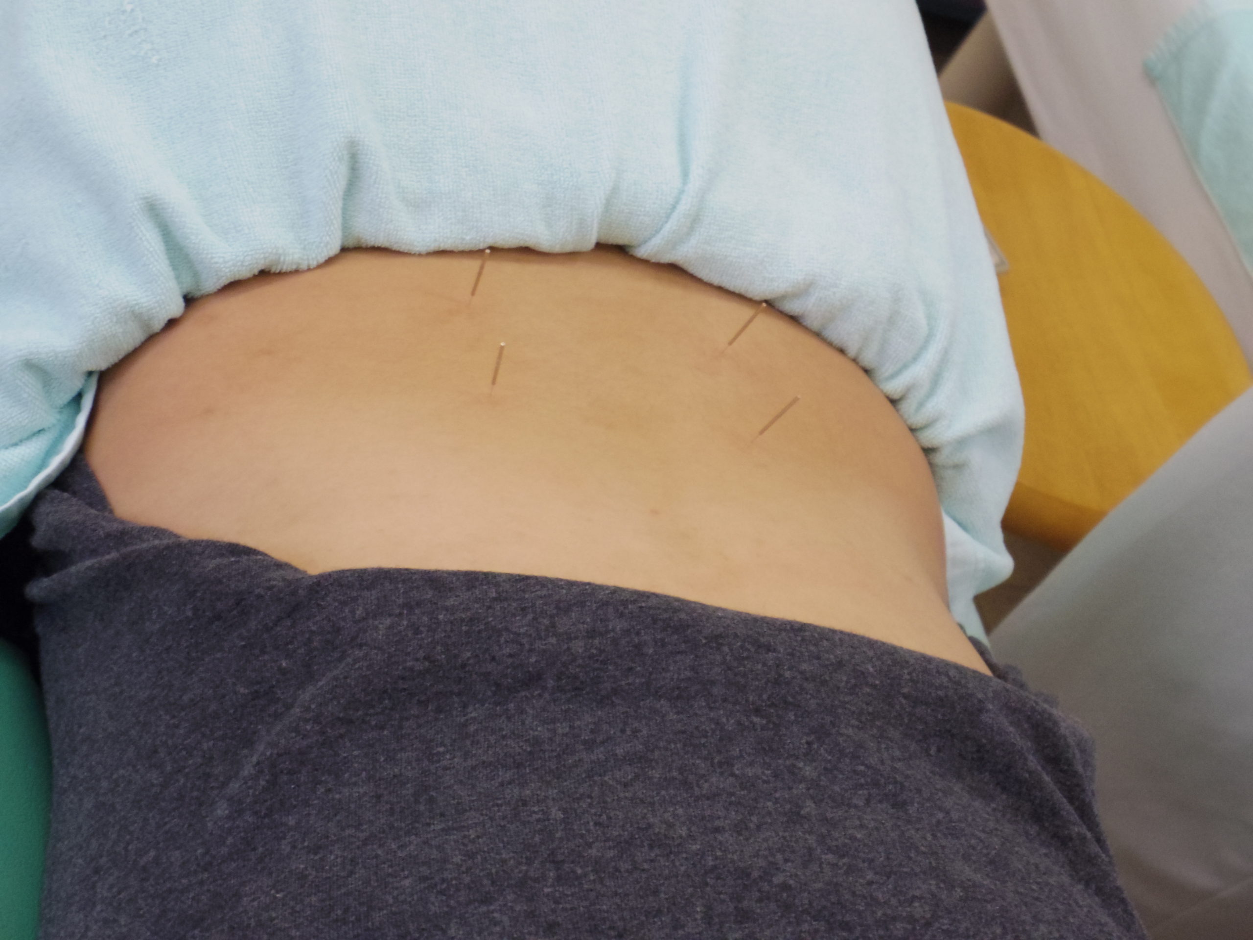 針（刺さってる）